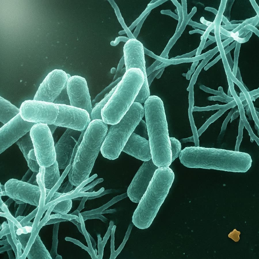 Batteri lattici visti al microscopio: bastoncelli e filamenti su fondo scuro